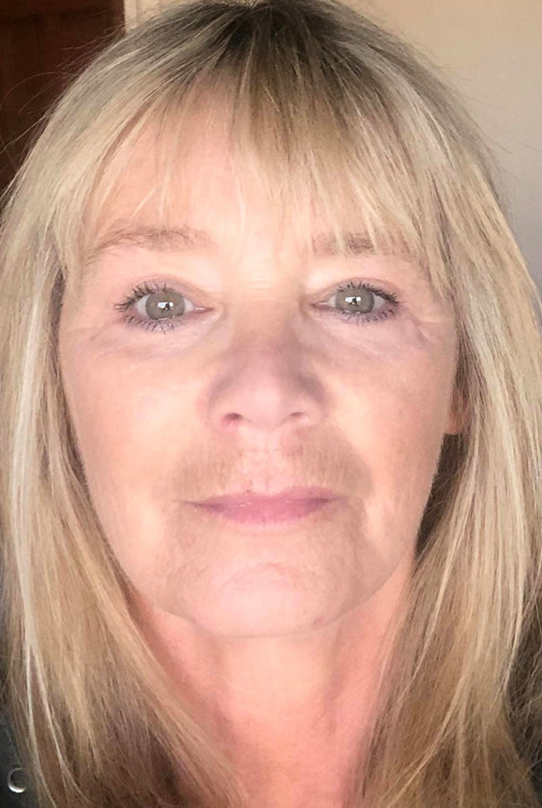 Image of Absoluter Isobel after using Absolute Collagen's Collagen Supplement