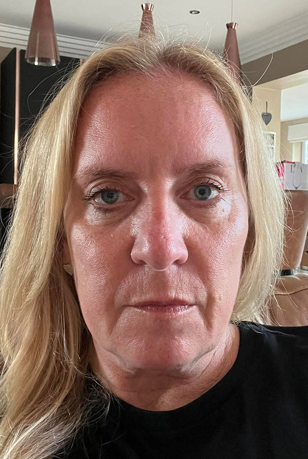 Image of Absoluter Paula before taking Absolute Collagen, Marine Collagen Supplements