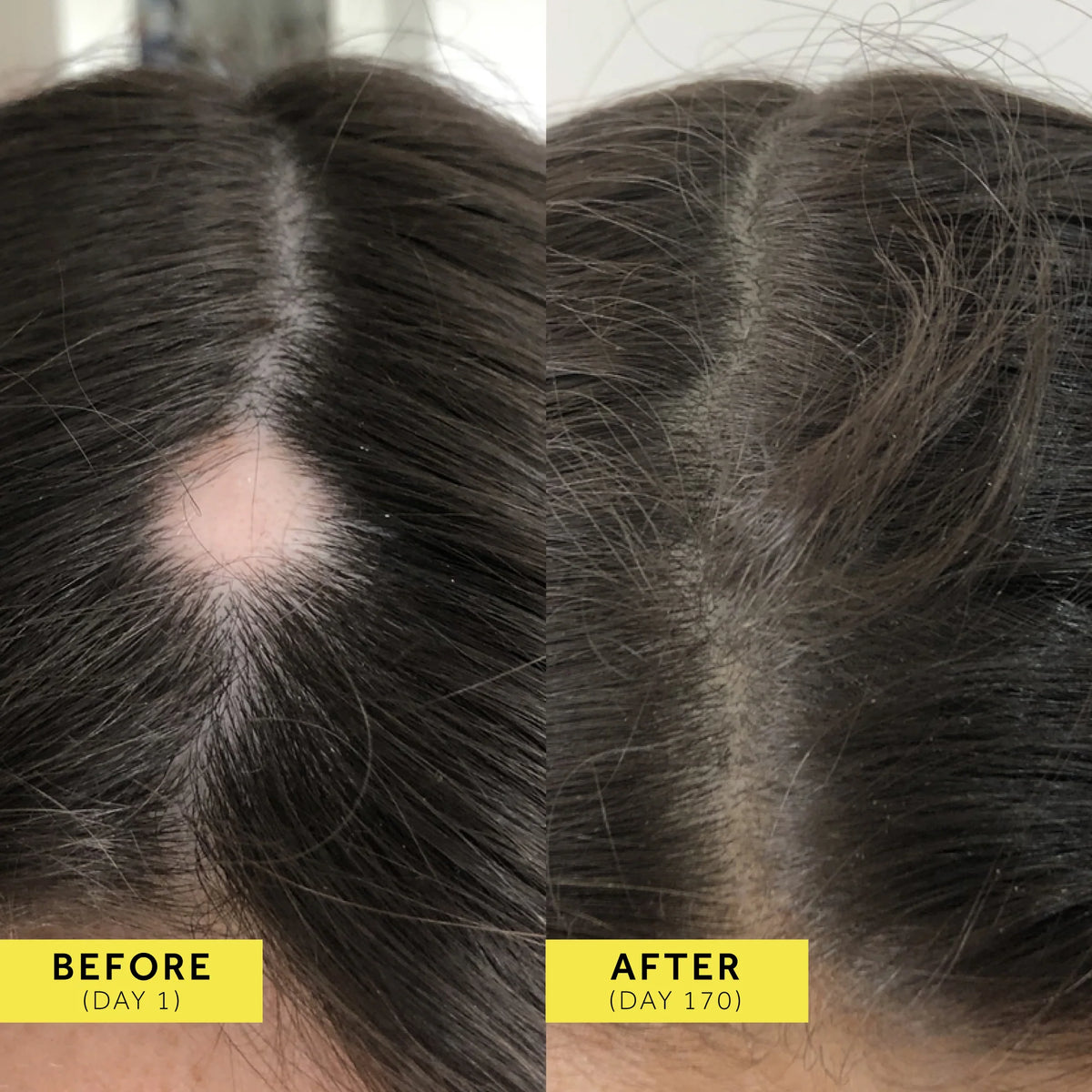 Why does my hair need Absolute Collagen?