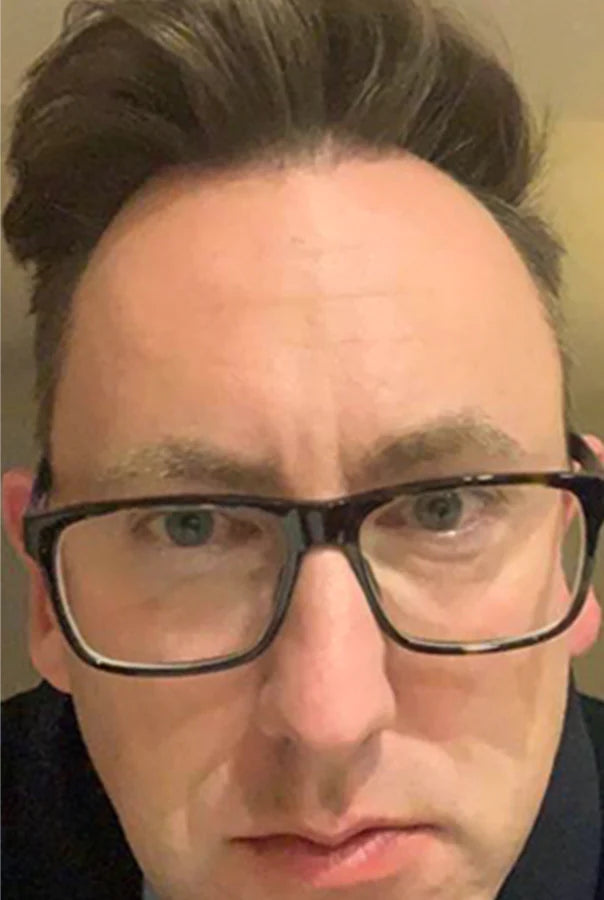 Image of Absoluter Ross after using Absolute Collagen's Collagen Supplement