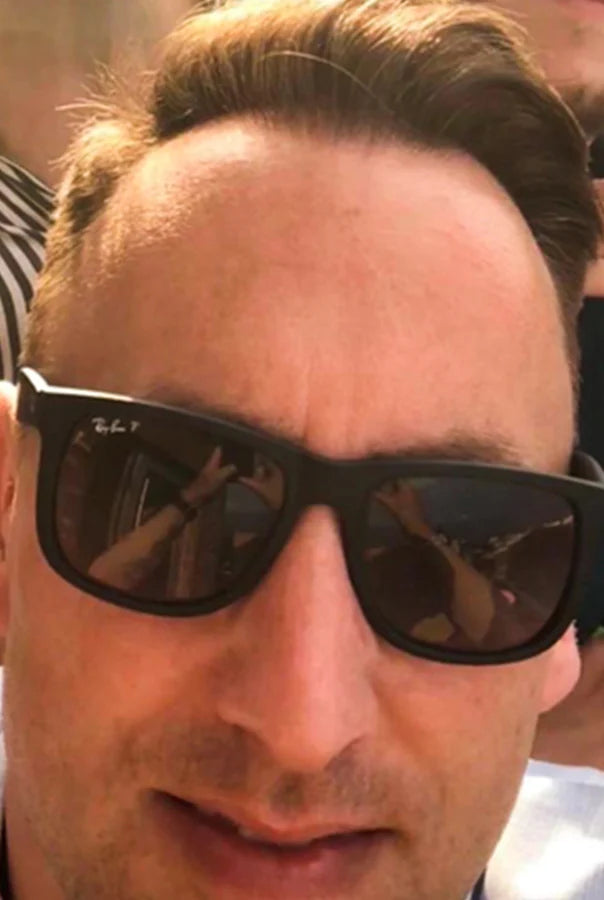 Image of Absoluter Ross before using Absolute Collagen's Collagen Supplement